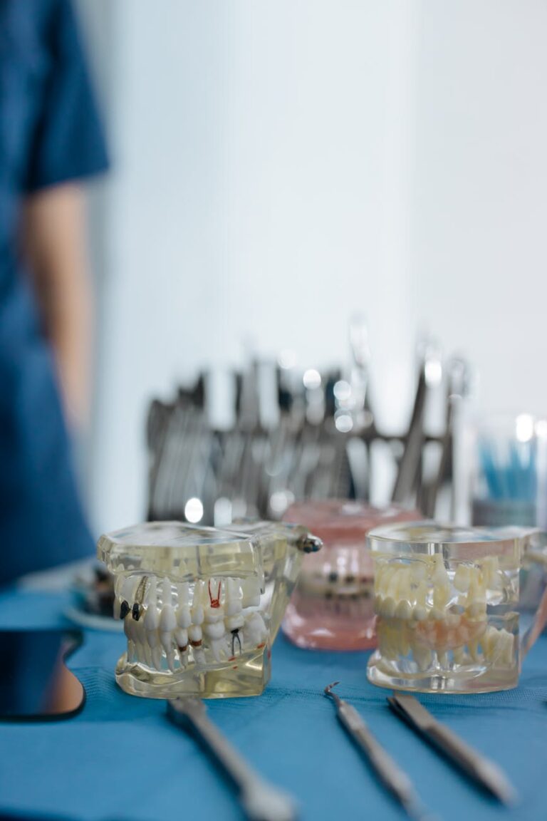 Powody, które powinny przekonać Cię do wyboru implantów zębowych