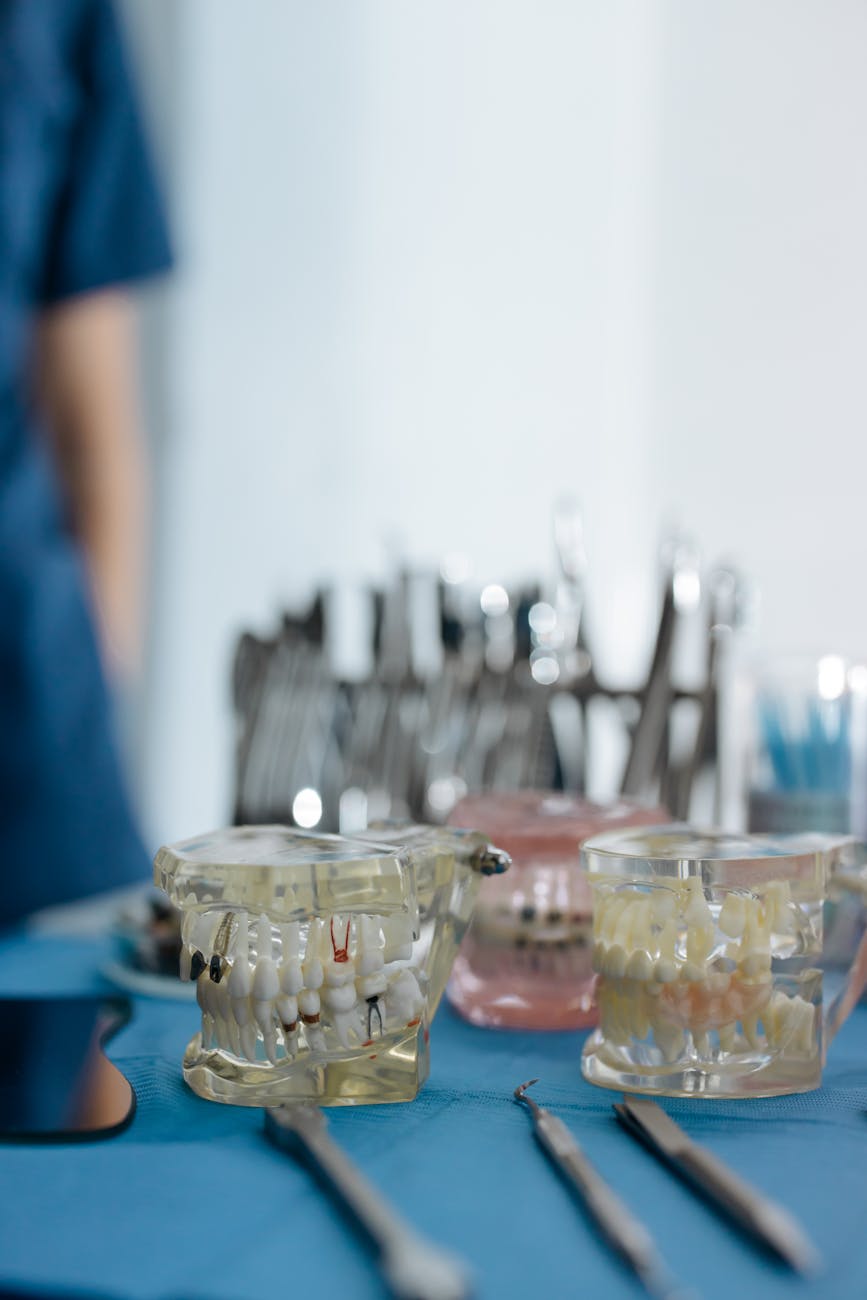 Powody, które powinny przekonać Cię do wyboru implantów zębowych